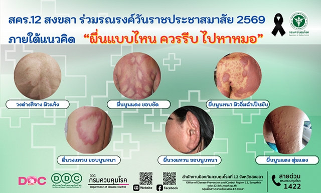 สคร.12 สงขลา ร่วมรณรงค์วันราชประชาสมาสัย 2569 ภ